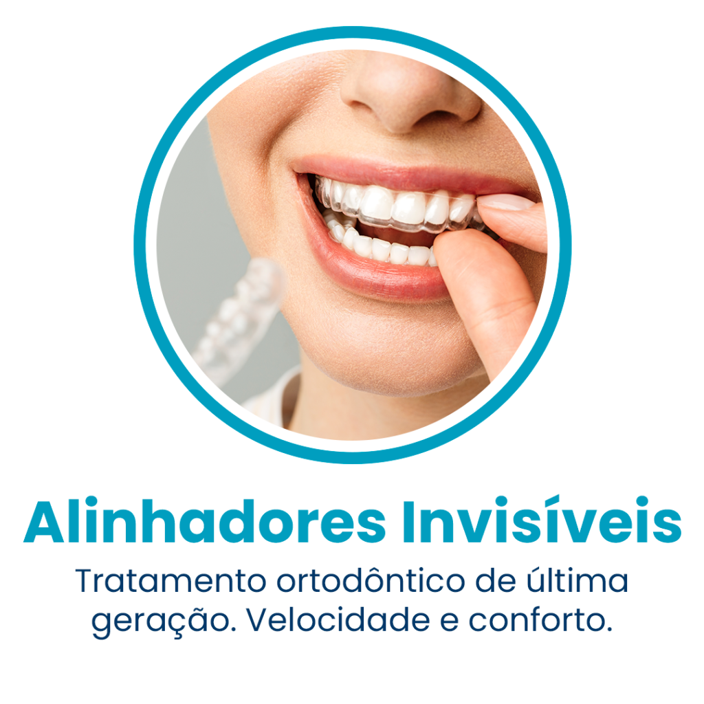 Alinhadores
