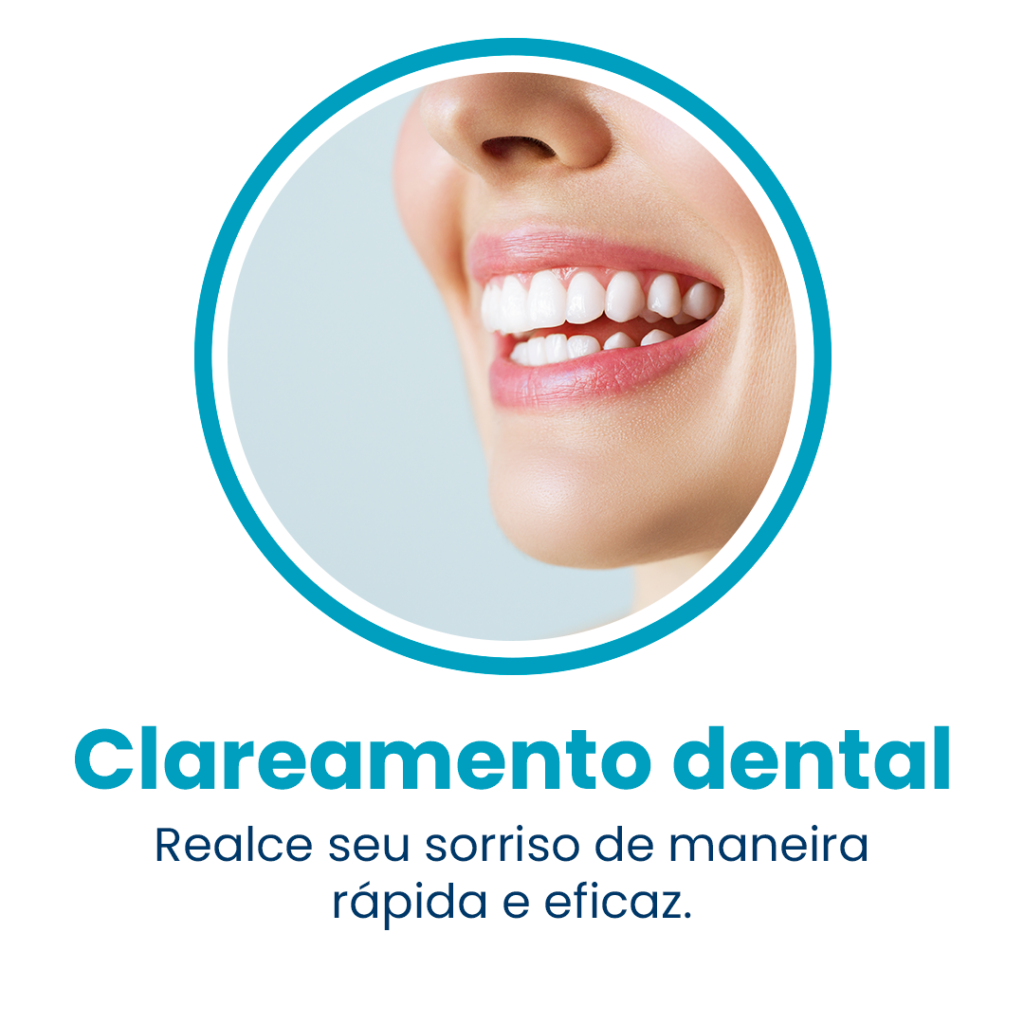 Clareamento