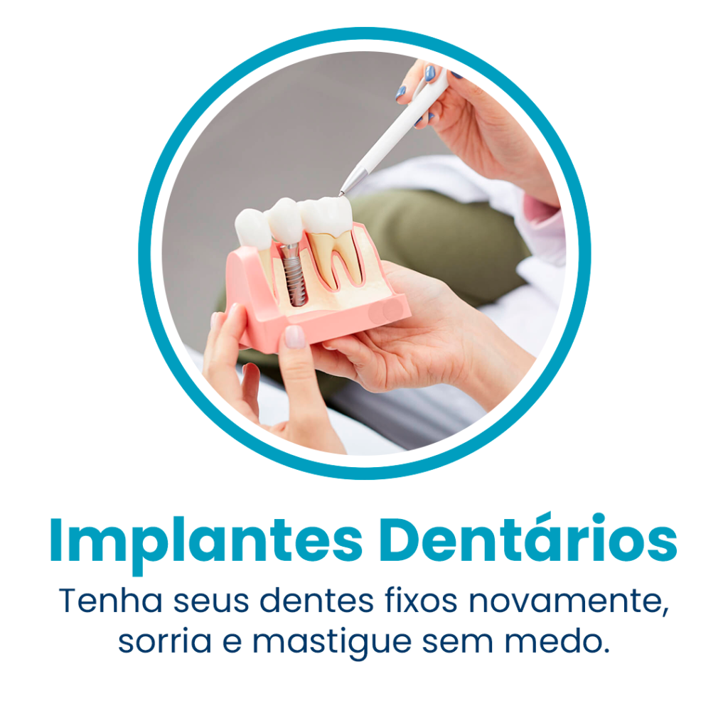 Implante
